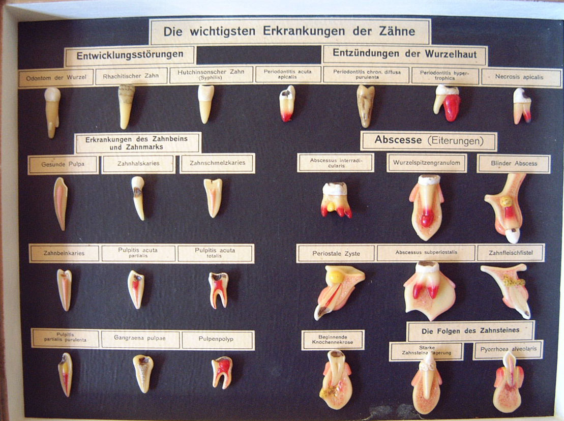 tannlegegrov09